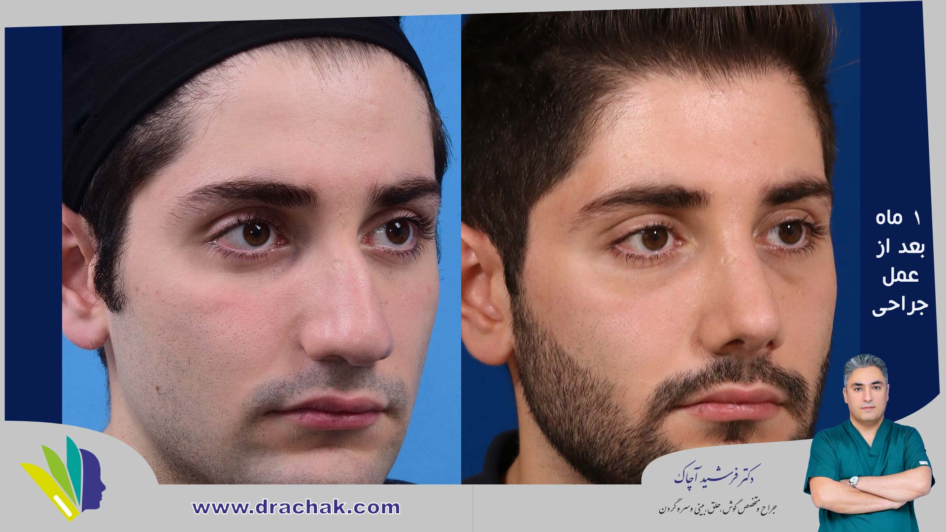 before after 2