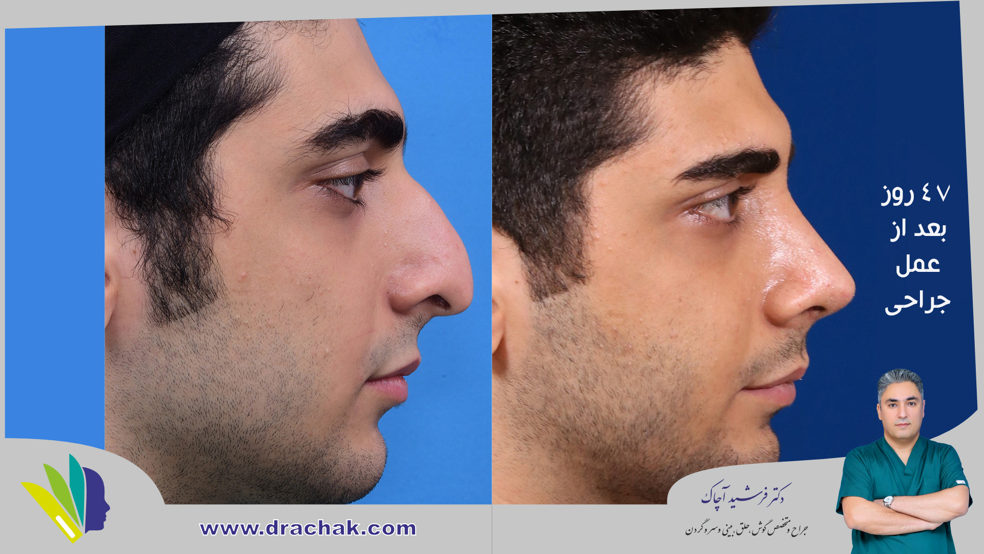 before after 8