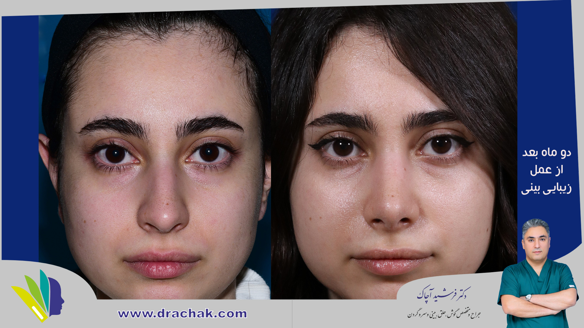 before after 5