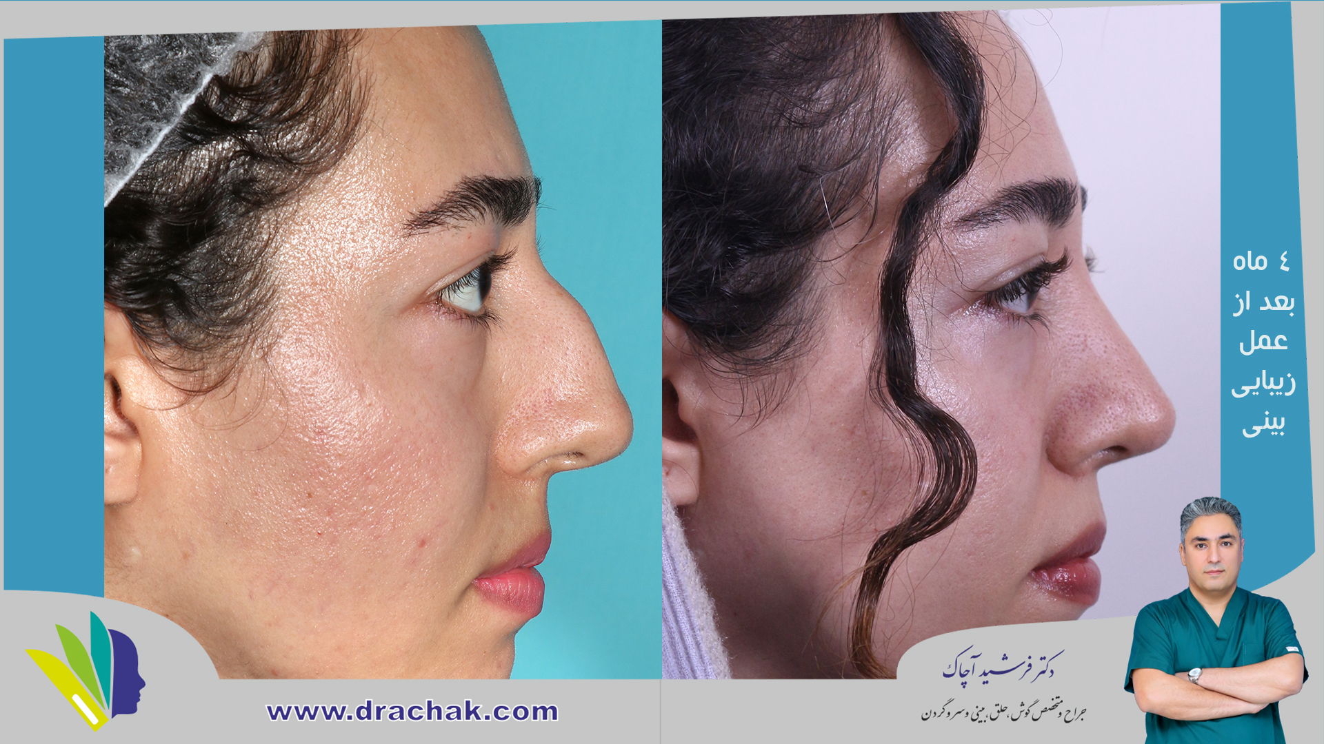 before after 9
