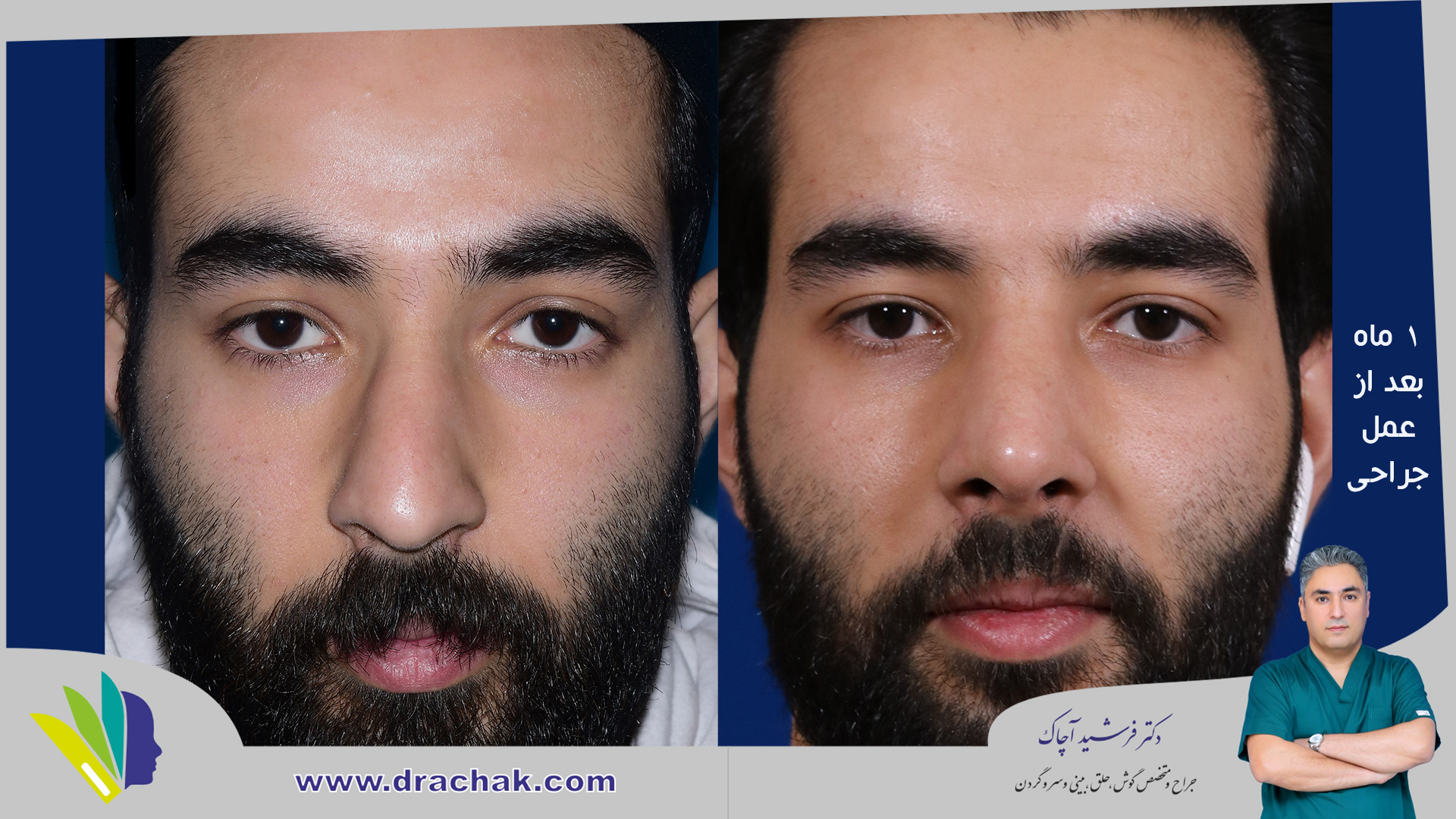 before after 6