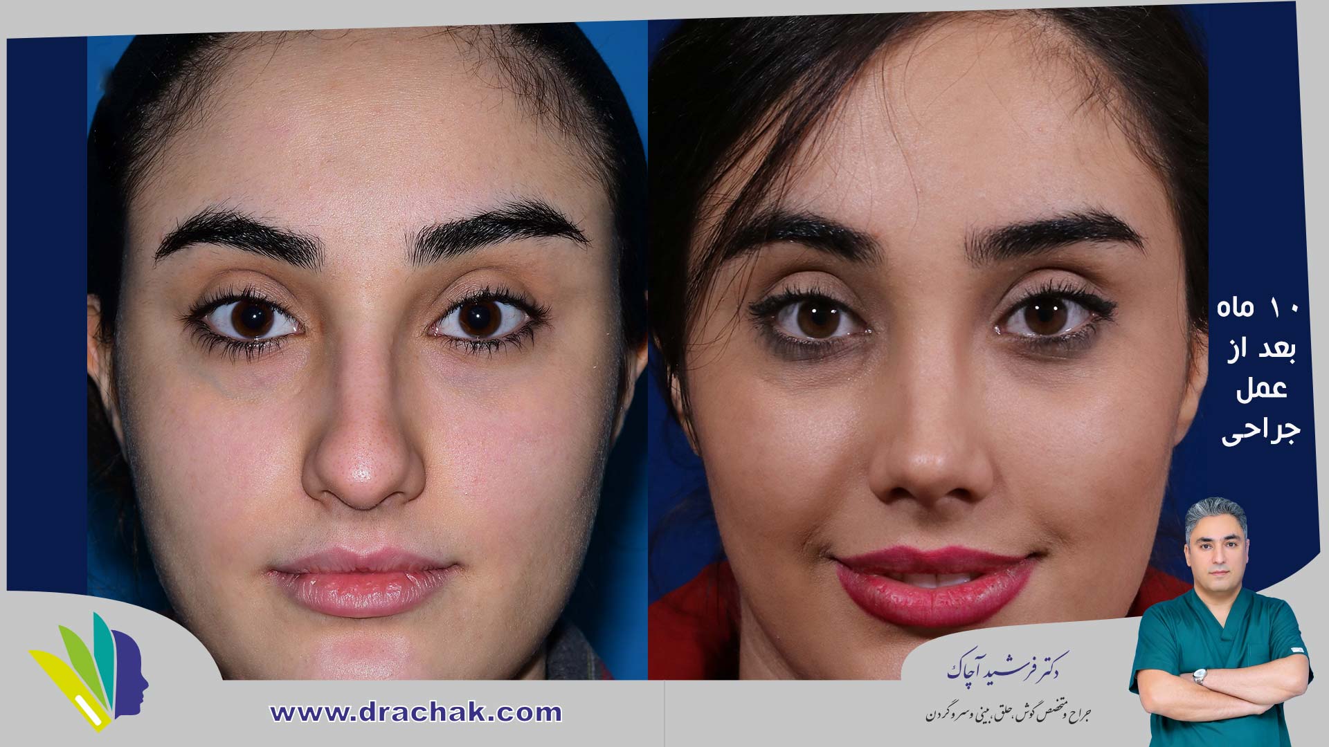 before after 7