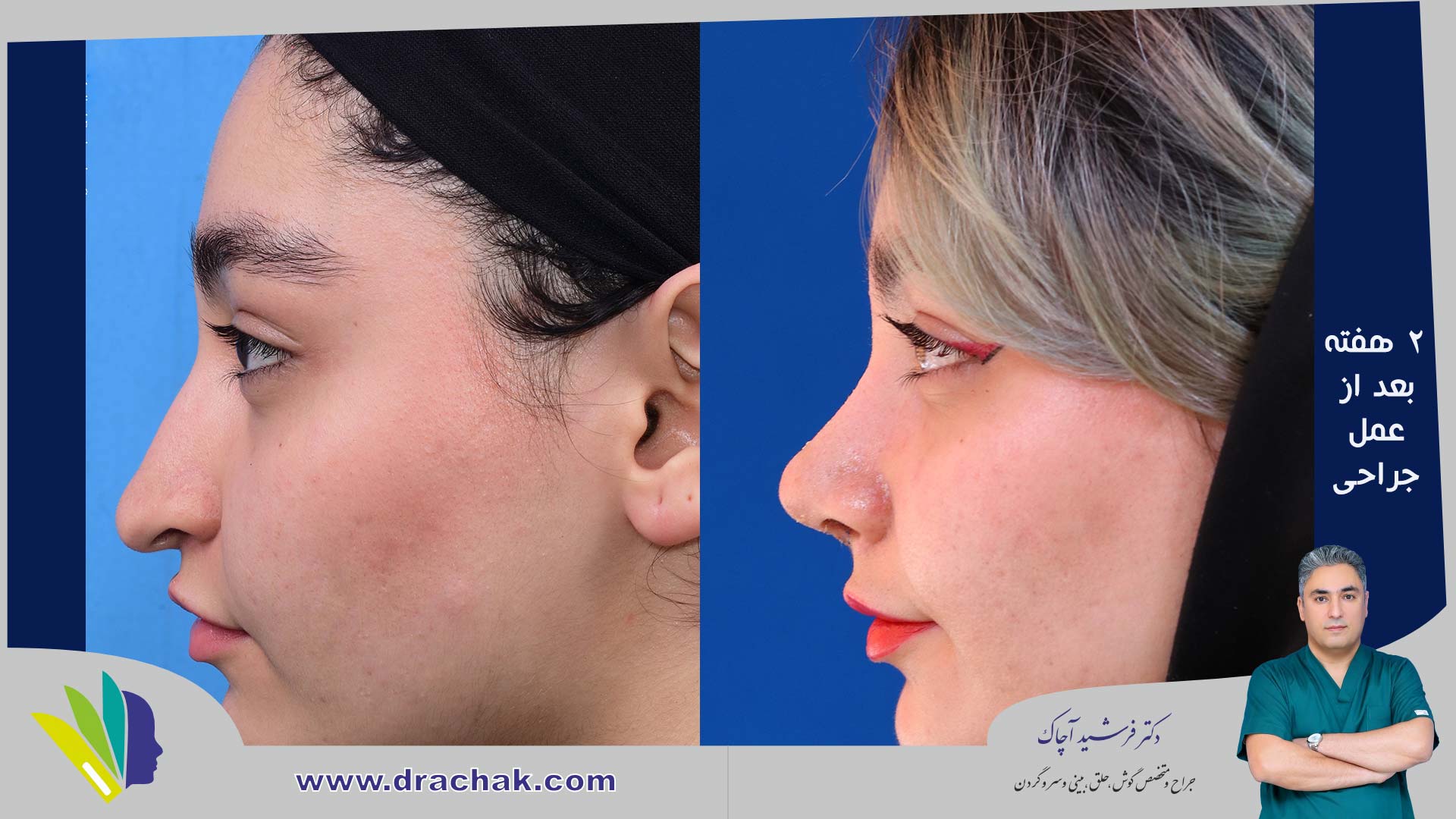 before after 3