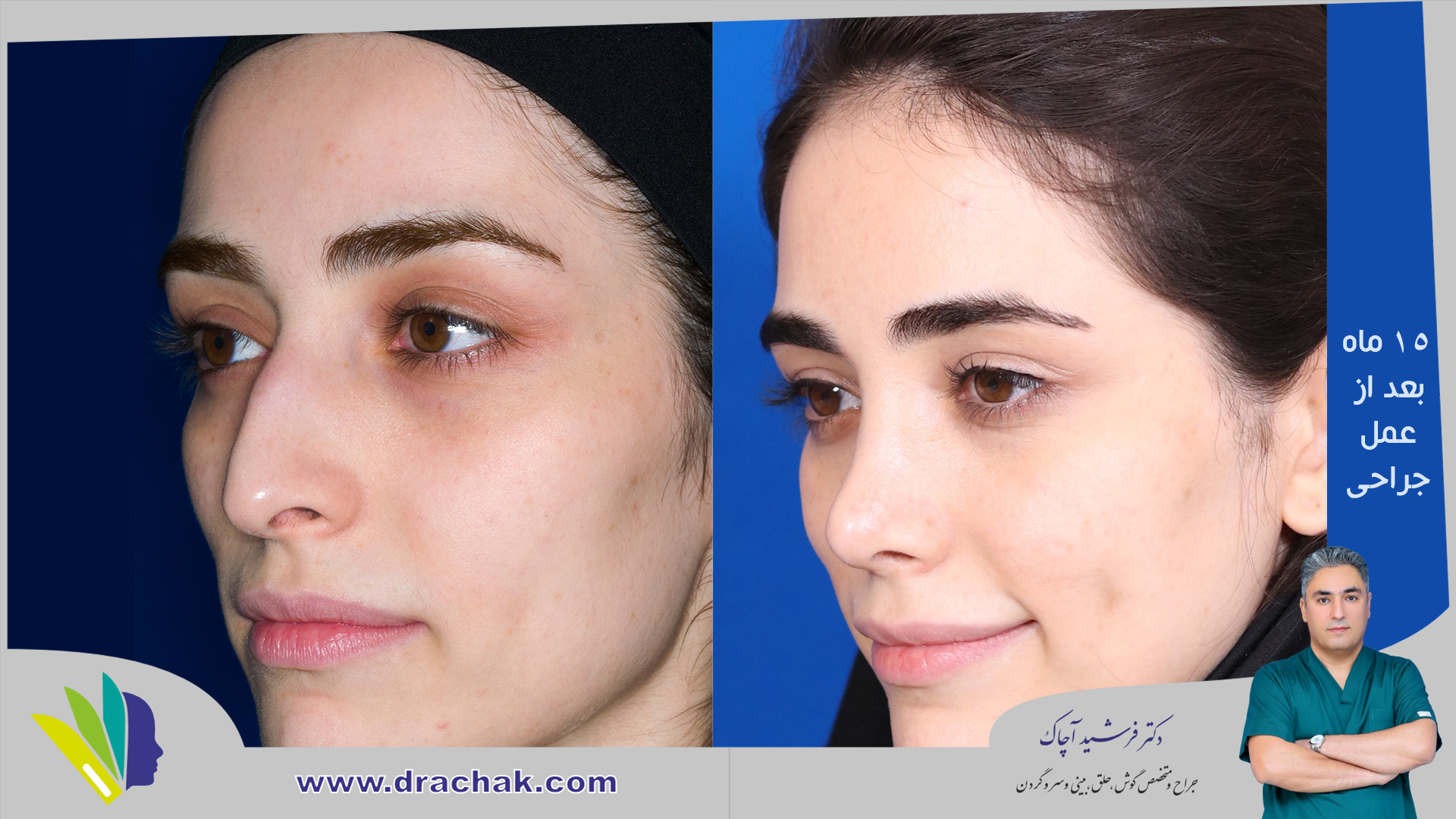 before after 1